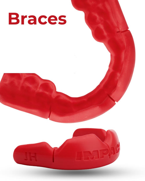 Braces-compatible Sportsguard3D mouthguard