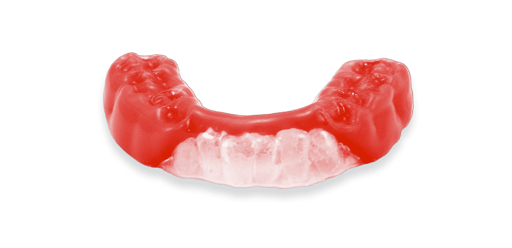PEPtrainer-Mouthguard